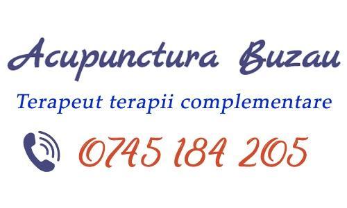 Chitu Alina - Cabinet de Acupunctura